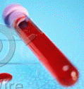 Blood Vial